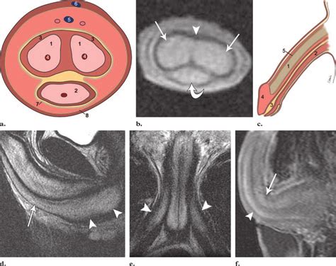 dick oic|The Penis: Anatomy and 3D Illustrations